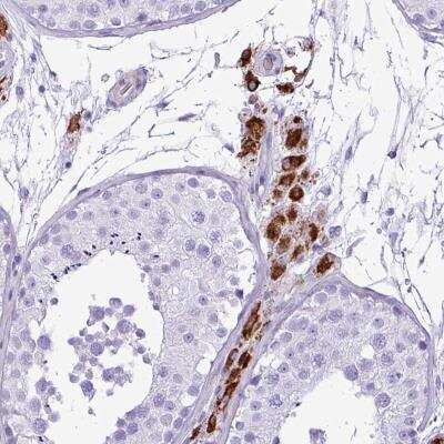 Immunohistochemistry: ZSCAN5 Antibody [NBP2-46665] - Staining of human testis shows strong cytoplasmic positivity in Leydig cells.