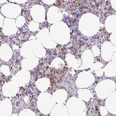 Immunohistochemistry: ZSCAN5 Antibody [NBP2-46692] - Staining of human bone marrow shows distinct cytoplasmic positivity in subsets of hematopoietic cells.