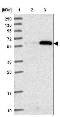 Western Blot: ZSCAN5 Antibody [NBP2-46665] - Lane 1: Marker [kDa] 250, 130, 95, 72, 55, 36, 28, 17, 10, Lane 2: Human cell line RT-4, Lane 3: Human cell line U-251 MG