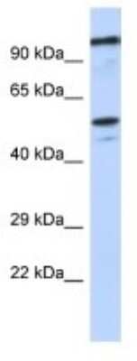 Western Blot: ZSCAN5 Antibody [NBP3-10384] - Western blot analysis of ZSCAN5 in SH-SYSY Whole Cell lysates. Antibody dilution at 1.0ug/ml