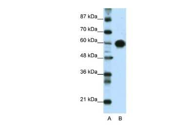 Western Blot: ZSCAN5 Antibody [NBP3-10385] - Western blot analysis using NBP3-10385 on Transfected 293T  as a positive control. Antibody Titration: 0.2-1 ug/ml