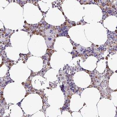 Immunohistochemistry: ZSCAN5C Antibody [NBP2-46728] - Staining of human bone marrow shows distinct cytoplasmic positivity in subsets of hematopoietic cells.