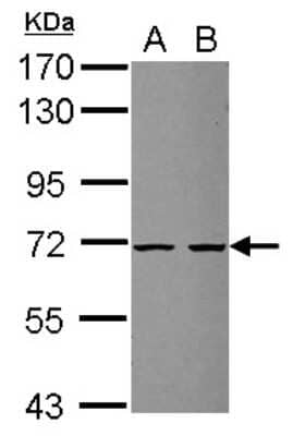 Western Blot ZSWIM2 Antibody - BSA Free