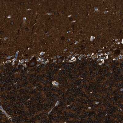 Immunohistochemistry-Paraffin ZSWIM5 Antibody - BSA Free