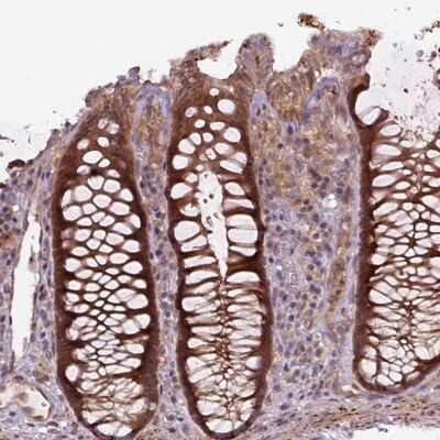 Immunohistochemistry-Paraffin: ZSWIM7 Antibody [NBP2-30937] - Staining of human colon shows strong cytoplasmic positivity in glandular cells.