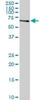 Western Blot ZWILCH Antibody