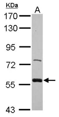 Western Blot: ZWILCH Antibody [NBP2-21058] - Sample (30 ug of whole cell lysate) A: IMR32 7. 5% SDS PAGE gel, diluted at 1:1000.