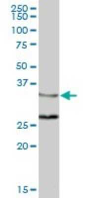 Western Blot: ZWINT Antibody [H00011130-B01P] - Analysis of ZWINT expression in human liver.
