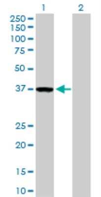 Western Blot: ZWINT Antibody [H00011130-D01P] - analysis of ZWINT expression in transfected 293T cell line by ZWINT MaxPab rabbit polyclonal antibody. Lane 1: ZWINT transfected lysate (31.20 KDa). Lane 2: Non-transfected lysate.