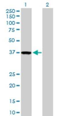 Western Blot: ZWINT Antibody [H00011130-D01P] - Analysis of ZWINT expression in transfected 293T cell line by ZWINT polyclonal antibody.Lane 1: ZWINT transfected lysate(31.20 KDa).Lane 2: Non-transfected lysate.