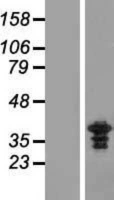 Western Blot: ZWINT Overexpression Lysate (Adult Normal) [NBP2-05936] Left-Empty vector transfected control cell lysate (HEK293 cell lysate); Right -Over-expression Lysate for ZWINT.