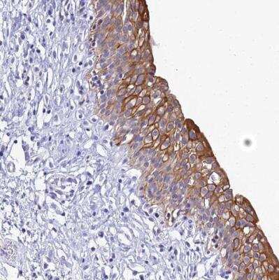 Immunohistochemistry-Paraffin: ZXDA Antibody [NBP2-54712] - Staining of human urinary bladder shows strong cytoplasmic and membranous positivity in urothelial cells.