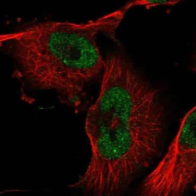 Immunocytochemistry/Immunofluorescence: ZXDB Antibody [NBP2-54712] - ZXDA Antibody [NBP2-54712] - Staining of human cell line U-251 MG shows localization to nucleoplasm.