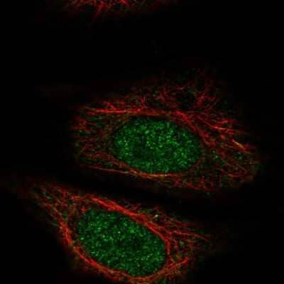 Immunocytochemistry/ Immunofluorescence ZYG11A Antibody - BSA Free