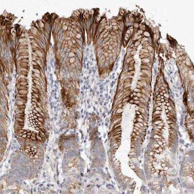 Immunohistochemistry-Paraffin ZYG11A Antibody - BSA Free