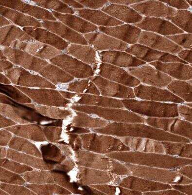 Immunohistochemistry-Paraffin: ZYG11B Antibody [NBP1-82255] -  Staining of human skeletal muscle shows strong cytoplasmic positivity in myocytes.
