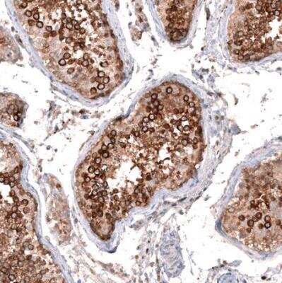 Immunohistochemistry-Paraffin: ZYG11B Antibody [NBP1-82255] - Staining of human testis shows moderate to strong cytoplasmic and membranous positivity in cells in seminiferious ducts.
