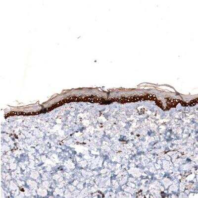 Immunohistochemistry-Paraffin: ZYG11B Antibody [NBP1-82255] - Staining of human skin shows strong membranous positivity in squamous epithelial cells.