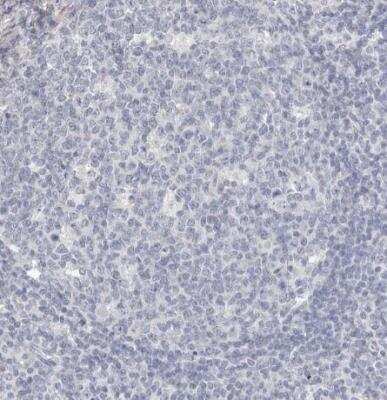 Immunohistochemistry-Paraffin: ZYG11B Antibody [NBP1-82255] - Staining of human lymphoid tissues shows no positivity in germinal center cells as expected.