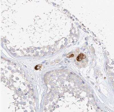 Immunohistochemistry-Paraffin: ZZEF1 Antibody [NBP1-83827] -  Staining of human testis shows moderate to strong cytoplasmic positivity in Leydig cells.