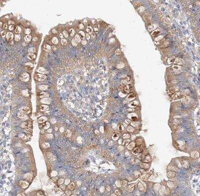 Immunohistochemistry-Paraffin ZZEF1 Antibody - BSA Free