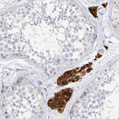 Immunohistochemistry-Paraffin: ZZEF1 Antibody [NBP1-83828] - Staining of human testis shows strong nuclear and cytoplasmic positivity in Leydig cells.