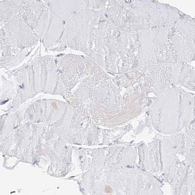 Immunohistochemistry-Paraffin: ZZEF1 Antibody [NBP1-83828] - Staining of human skeletal muscle shows no positivity in myocytes.