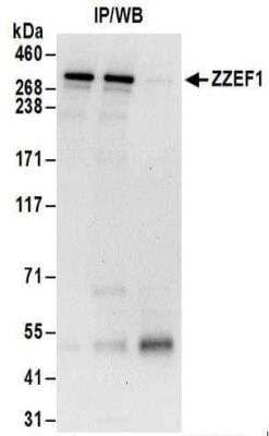 Immunoprecipitation: ZZEF1 Antibody [NBP2-32120] - Whole cell lysate (1 mg for IP; 20% of IP loaded) from 293T cells.  Antibodies:  Affinity purified rabbit anti-ZZEF1 antibody NBP2-32120 used for IP at 6 ug/mg lysate.  ZZEF1 was also immunoprecipitated by rabbit anti-ZZEF1 antibody NBP2-32120.  For blotting immunoprecipitated ZZEF1, NBP2-32120was used at 0.4 ug/ml.  Detection: Chemiluminescence with an exposure time of 30 seconds.