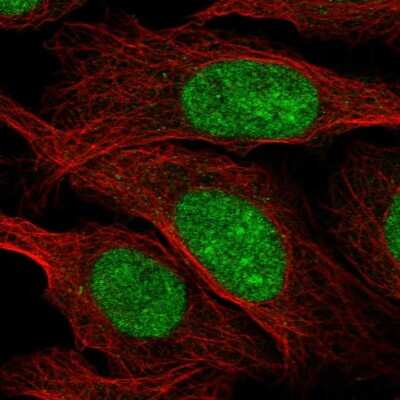 Immunocytochemistry/Immunofluorescence: ZZZ3 Antibody [NBP2-58530] - Staining of human cell line U-2 OS shows localization to nucleus & nucleoli. Antibody staining is shown in green.