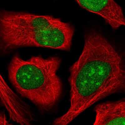 Immunocytochemistry/ Immunofluorescence ZZZ3 Antibody - BSA Free