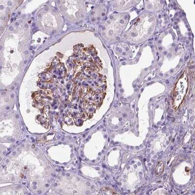 Immunohistochemistry: ZZZ3 Antibody [NBP2-49475] - Staining of human kidney shows moderate cytoplasmic positivity in glomeruli.