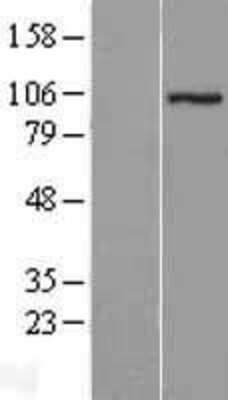 Western Blot: ZZZ3 Overexpression Lysate (Adult Normal) [NBL1-18280] Left-Empty vector transfected control cell lysate (HEK293 cell lysate); Right -Over-expression Lysate for ZZZ3.