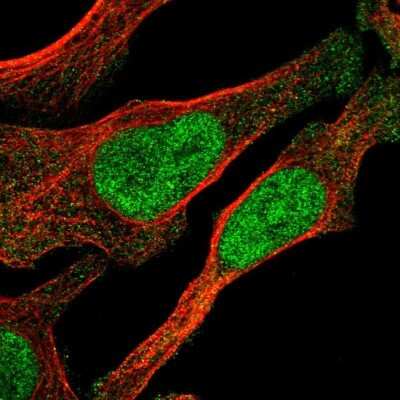 Immunocytochemistry/Immunofluorescence: Zeta Opioid Receptor Antibody [NBP1-90340] - Immunofluorescent staining of human cell line U-2 OS shows localization to nucleoplasm.