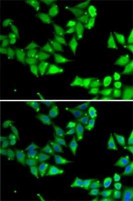 Immunocytochemistry/Immunofluorescence: Zeta Opioid Receptor Antibody [NBP2-94528] - Analysis of MCF7 cells using Zeta Opioid Receptor . Blue: DAPI for nuclear staining.