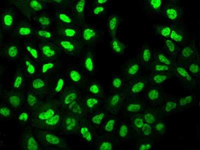 Immunocytochemistry/Immunofluorescence: Zeta Opioid Receptor Antibody [NBP2-97488] - Immunofluorescence staining of Zeta Opioid Receptor in U2OS cells. Cells were fixed with 4% PFA, permeabilzed with 0.1% Triton X-100 in PBS, blocked with 10% serum, and incubated with rabbit anti-Human Zeta Opioid Receptor polyclonal antibody (dilution ratio 1:200) at 4C overnight. Then cells were stained with the Alexa Fluor(R)488-conjugated Goat Anti-rabbit IgG secondary antibody (green). Positive staining was localized to Nucleus .