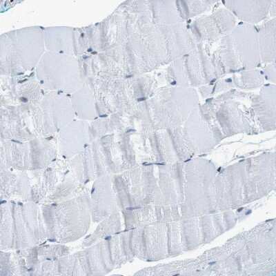 Immunohistochemistry-Paraffin: Zeta Opioid Receptor Antibody [NBP1-90340] - Staining of human skeletal muscle shows low expression as expected.