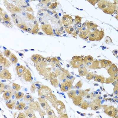 Immunohistochemistry-Paraffin: Zeta Opioid Receptor Antibody [NBP2-94528] - Paraffin-embedded human stomach using Zeta Opioid Receptor .