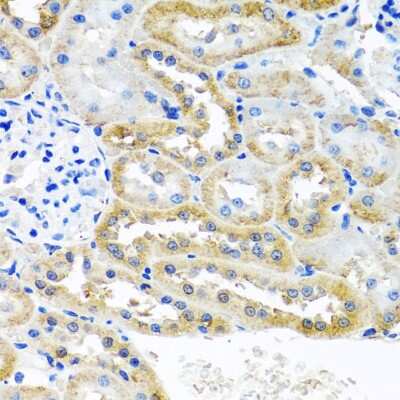 Immunohistochemistry-Paraffin: Zeta Opioid Receptor Antibody [NBP2-94528] - Paraffin-embedded rat kidney using Zeta Opioid Receptor .