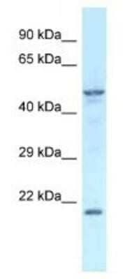 Western Blot: Zfp113 Antibody [NBP1-91373] - Mouse Kidney Lysate 1ug/ml  Gel Concentration 12%