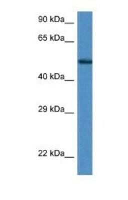 Western Blot: Zfp275 Antibody [NBP1-91319] - Lane: Mouse Kidney Lysate, ANtobody Titration is 1 ug/ml and Gel concentration is 12%