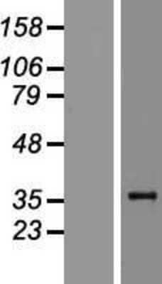 Western Blot: Zhangfei Overexpression Lysate (Adult Normal) [NBP2-10610] Left-Empty vector transfected control cell lysate (HEK293 cell lysate); Right -Over-expression Lysate for Zhangfei.