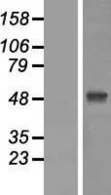 Western Blot: Zic1 Overexpression Lysate (Adult Normal) [NBP2-08012] Left-Empty vector transfected control cell lysate (HEK293 cell lysate); Right -Over-expression Lysate for Zic1.