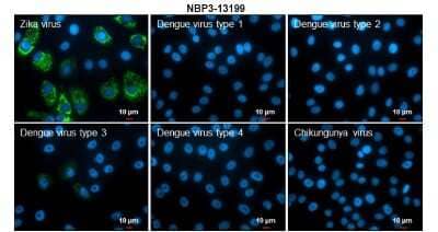 Immunocytochemistry/ Immunofluorescence Zika Virus (H/PF/2013) Envelope Antibody - BSA Free
