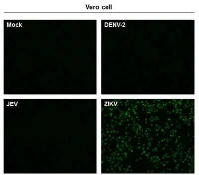 Immunocytochemistry/Immunofluorescence: Zika Virus (H/PF/2013) Envelope Antibody [NBP3-13205] - Immunofluorescent analysis of non-infected and infected vero cells using Zika Virus (H/PF/2013) Envelope antibody (NBP3-13205). Green: Zika Virus (H/PF/2013) Envelope antibody (NBP3-13205) diluted at 1:500.
