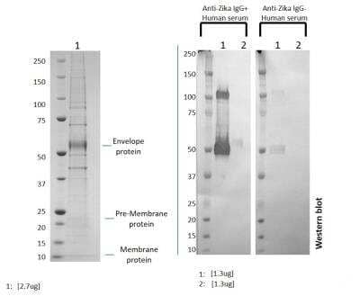 SDS-PAGE Recombinant Virus Zika Virus VLP Suriname Z1106033 Protein