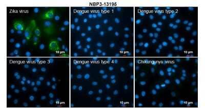 Immunocytochemistry/Immunofluorescence: Zika virus NS2B Antibody [NBP3-13195] - Immunofluorescent analysis of arboviruses infected cells using Zika virus NS2B antibody (NBP3-13195). Samples: EUROIMMUN Arboviral Fever Mosaic 2 slide (FR 2668-1010-1). Green: Zika virus NS2B antibody (NBP3-13195) diluted at 1:100. Blue: Hoechst 33342 staining. Scale bar = 10 um.