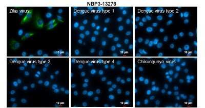 Immunocytochemistry/Immunofluorescence: Zika virus NS4A Antibody [NBP3-13278] - Immunofluorescent analysis of arboviruses infected cells using Zika virus NS4A antibody (NBP3-13278). Samples: EUROIMMUN Arboviral Fever Mosaic 2 slide (FR 2668-1010-1). Green: Zika virus NS4A antibody (NBP3-13278) diluted at 1:500. Blue: Hoechst 33342 staining. Scale bar = 10 um.