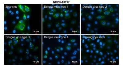 Immunocytochemistry/Immunofluorescence: Zika virus NS4B Antibody [NBP3-13197] - Immunofluorescent analysis of arboviruses infected cells using Zika virus NS4B antibody (NBP3-13197). Samples: EUROIMMUN Arboviral Fever Mosaic 2 slide (FR 2668-1010-1). Green: Zika virus NS4B antibody (NBP3-13197) diluted at 1:100. Blue: Hoechst 33342 staining. Scale bar = 10 um.