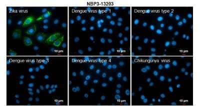 Immunocytochemistry/Immunofluorescence: Zika virus NS4B Antibody [NBP3-13203] - Immunofluorescent analysis of arboviruses infected cells using Zika virus NS4B antibody (NBP3-13203). Samples: EUROIMMUN Arboviral Fever Mosaic 2 slide (FR 2668-1010-1). Green:Zika virus NS4B antibody (NBP3-13203) diluted at 1:500. Blue: Hoechst 33342 staining. Scale bar = 10 um.