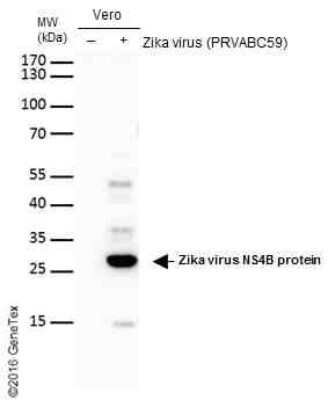 Western Blot: Zika virus NS4B Antibody [NBP3-13197] - Non-infected (-) and infected (+) vero cells (15 ug) were separated by gradient gel, and the membrane was blotted with Zika virus NS4B antibody (NBP3-13197) diluted at 1:2000. The HRP-conjugated anti-rabbit IgG antibody (NBP2-19301) was used to detect the primary antibody.